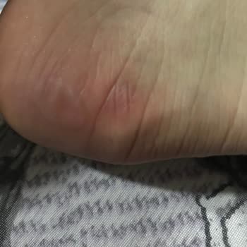 Hopesneakers.tr Orijinal Diyerek Çok Kalitesiz Ayakkabı Sattılar Ayağım Çok Kötü Oldu