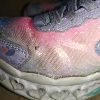 Skechers Spor Ayakkabı Kalitesizliği