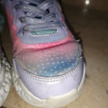 Skechers Spor Ayakkabı Kalitesizliği
