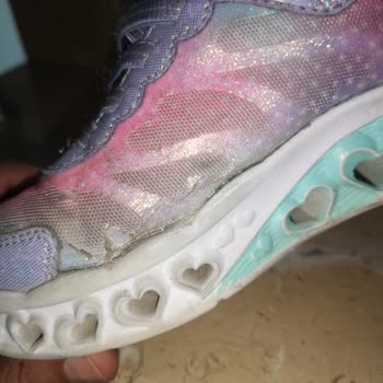 Skechers Spor Ayakkabı Kalitesizliği