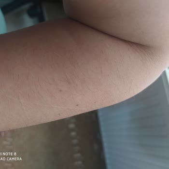 Ayşe Çiçekdağı Beauty Lazer Epilasyondan Memnun Kalmadım!