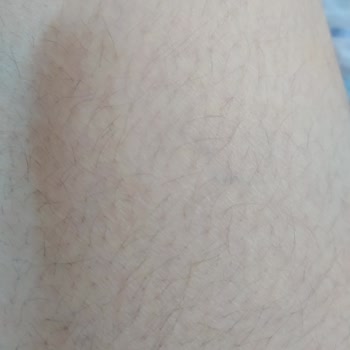 Ayşe Çiçekdağı Beauty Lazer Epilasyondan Memnun Kalmadım!