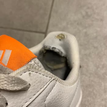 Adidas Ayakkabı Pişmanlığı Aldıktan 3 Ay Sonra Deforme Oluyor