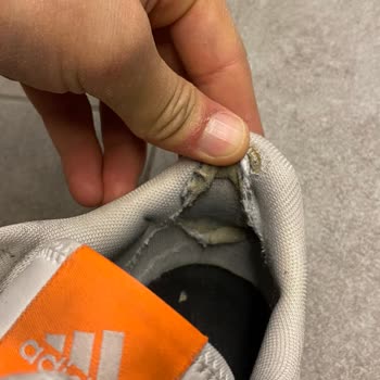 Adidas Ayakkabı Pişmanlığı Aldıktan 3 Ay Sonra Deforme Oluyor