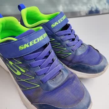 Skechers Ürettiği Kusurlu Ürünün Arkasında Durmuyor
