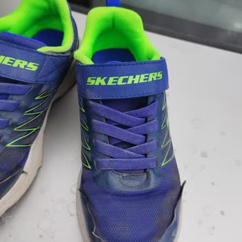 Skechers Ürettiği Kusurlu Ürünün Arkasında Durmuyor