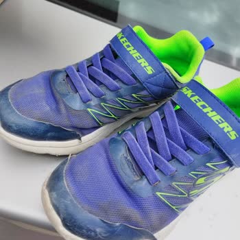 Skechers Ürettiği Kusurlu Ürünün Arkasında Durmuyor