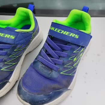 Skechers Ürettiği Kusurlu Ürünün Arkasında Durmuyor