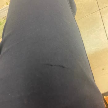 Çağrı Market Hasarlı Mağaza Reyonundan Kaynaklanan Mağduriyet