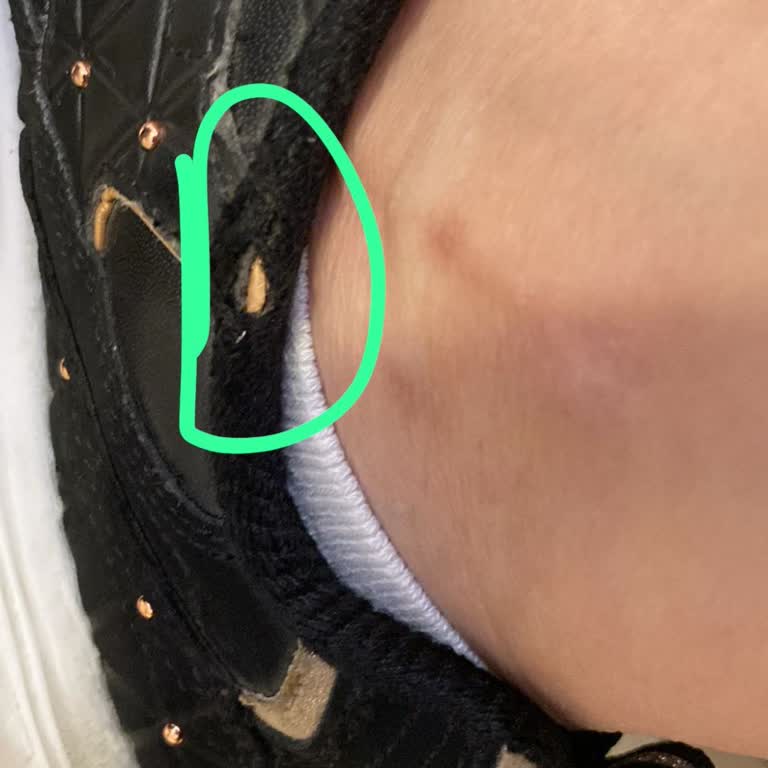 Skechers Memnun Kalmadım Hizmetinizden