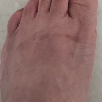 Tamer Tanca Ayakkabı Firmasının Duyarsızlığı