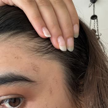 Acıbadem Bakırköy Lazer Epilasyon