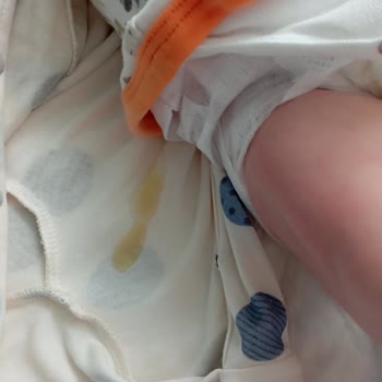 Sleepy Bio Natural Bebek Bezi Çiş Ve Kaka Sızdırıyor