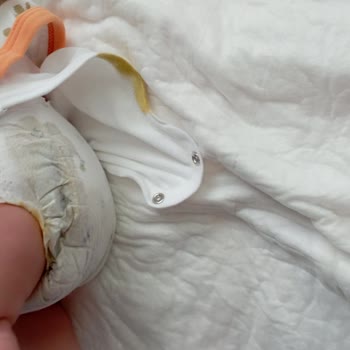 Sleepy Bio Natural Bebek Bezi Çiş Ve Kaka Sızdırıyor