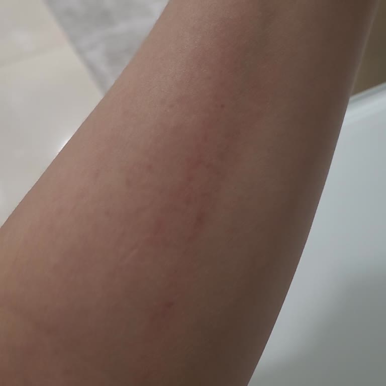 İstinye Üniversitesi Ortopedi De İnsan Ayrımı