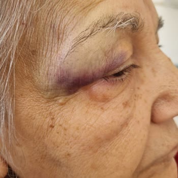 Sun Ekspres Tekerlekli Sandalye Getirmeme