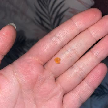 Vitaceel Sağlığımı Tehlikeye Atan Tablet Şoku!