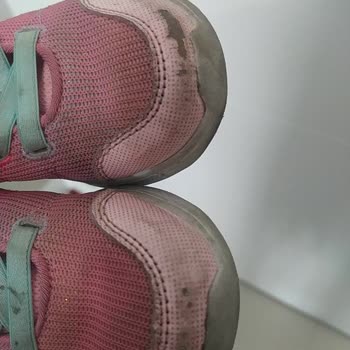 Skechers Ön Yüzü Soyuldu