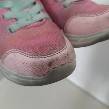 Skechers Ön Yüzü Soyuldu