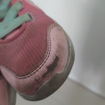 Skechers Ön Yüzü Soyuldu
