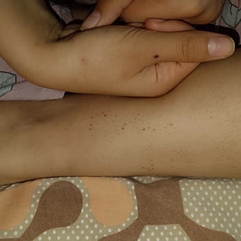 KYK Odamızda Böcek Var