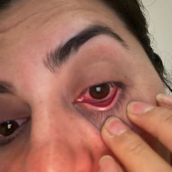 Uni Baby Şampuan Sorunu Ve Çözümlenmesi