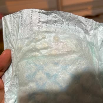 Prima Aktif Bebek Bezinde Sert Şeyler