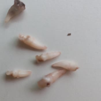 Yeditepe Üniversitesi Diş Hastanesi Onay Almadan Çocuğumun 5 Sağlam Dişini Çekti