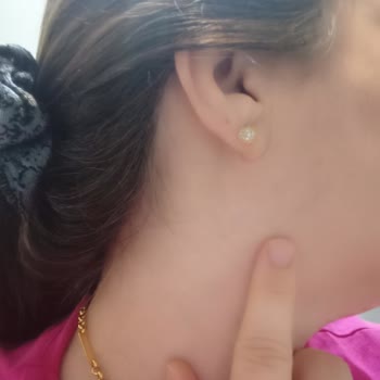 Mersin Büyükşehir Belediyesi İlaçlama Gereken Süreçte İlaçlamanın Yapılmaması