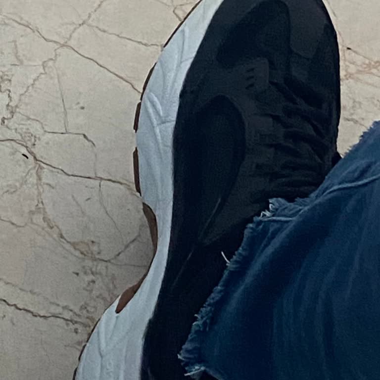 Skechers Ayakkabıdan Kaynaklı Ayak Ağrısı