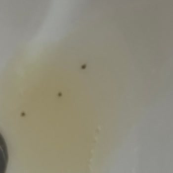 Urban Care Urban Marka Şampuandan Böcek Çıktı