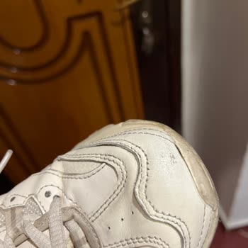 Skechers Malzeme Kalitesizliği Ve Sararması