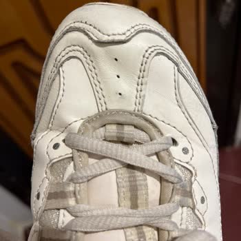 Skechers Malzeme Kalitesizliği Ve Sararması