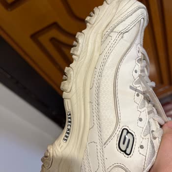 Skechers Malzeme Kalitesizliği Ve Sararması