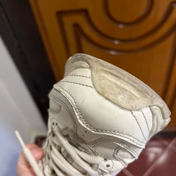 Skechers Malzeme Kalitesizliği Ve Sararması