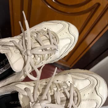 Skechers Malzeme Kalitesizliği Ve Sararması