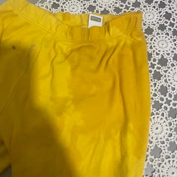 Molfix Bez Sızdırma, Bebeğim Pişik Oldu!