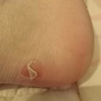 Derimod Sneaker Ayağımı Mahvetti