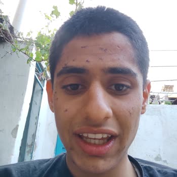 N11 Den Aldığım Agiva Markalı Soyulabilir Maskenin Cildi Tahriş Etmesi