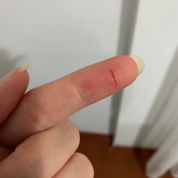 Assu Şişe Hatası Var