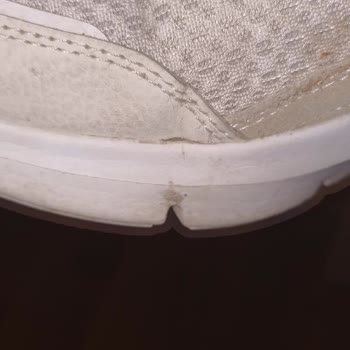 Skechers Hep Kullanıcımı Hatalı Olur (Skechers'E Yakışmadı)