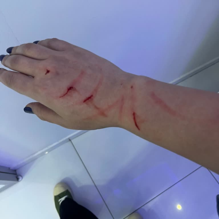 Este Keyff Güzellik Müdür Olduğunu İddia Eden Kadın Bize Hakaret Edip Saldırdı!