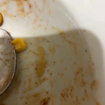 A101 Çokça Marka Süt Mısırdan Yabancı Cisim Çıktı!