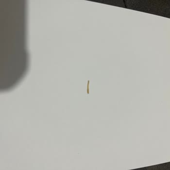 Şok Marketler Pestilden Yabancı Cisim Çıktı.