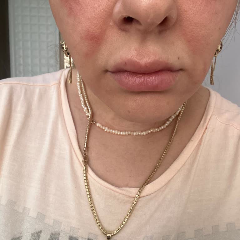 Vitayes Türkiye Yüz Germe Kremi Hayal Kırıklığı Yarattı