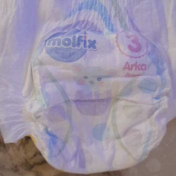 Molfix Marka Sahte Bez Çocuğumu Pisik Yaptı