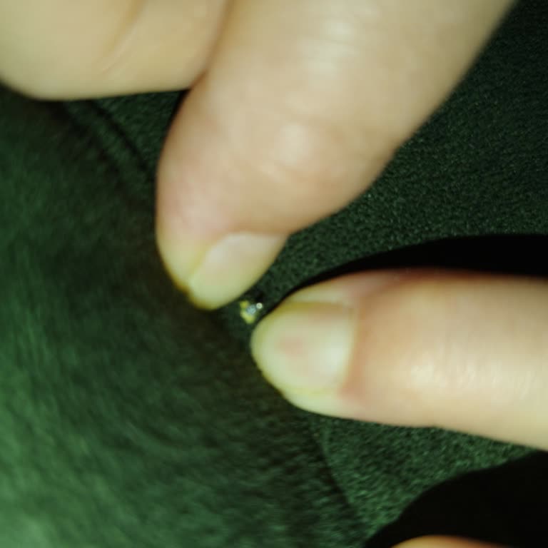 Sima Mobilya Koltuktan Çıkan Sivri Uçlu Vidalar