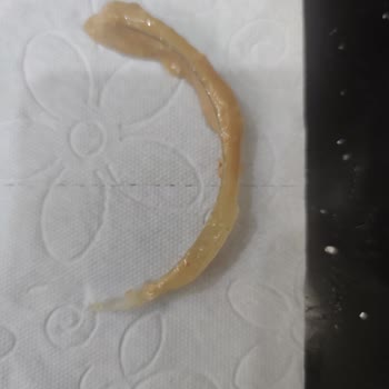 Kaya Çiftliği Fıstık Ezmesinde Tehlikeli Cam Parçası!