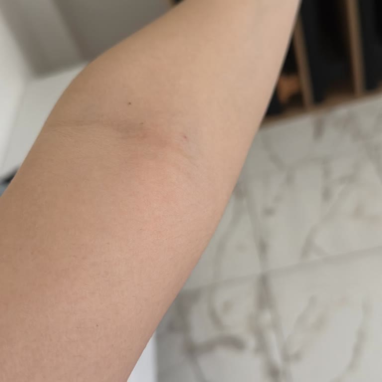 Özel Konak Hastanesi 26.04.2024 Tarihinde Kan Tahlili İçin Kan Aldılar Ve Kolumda His Yok