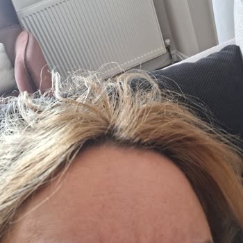 Dilan Polat Estetik Microblading Hüsranı: Güzellik Değil, Hayal Kırıklığı